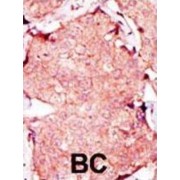 Adenylate Kinase 4, Mitochondrial (AK4) Antibody