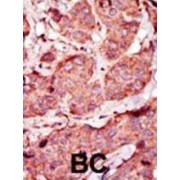 ATP-Dependent 6-Phosphofructokinase, Platelet Type (PFKP) Antibody
