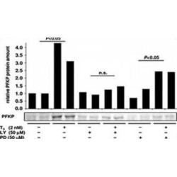 ATP-Dependent 6-Phosphofructokinase, Platelet Type (PFKP) Antibody