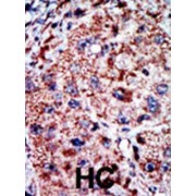 Phosphofructokinase, Liver (PFKL) Antibody