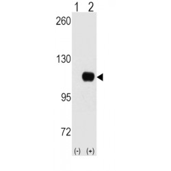 Hexokinase 1 (HK1) Antibody