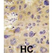 6-Phosphofructo-2-Kinase/fructose-2,6-Bisphosphatase 1 (PFKFB1) Antibody