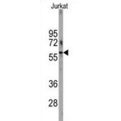 6-Phosphofructo-2-Kinase/fructose-2,6-Bisphosphatase 1 (PFKFB1) Antibody