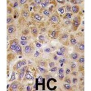 6-Phosphofructo-2-Kinase/fructose-2,6-Bisphosphatase 1 (PFKFB1) Antibody