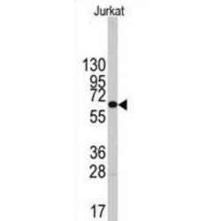 6-Phosphofructo-2-Kinase/fructose-2,6-Bisphosphatase 1 (PFKFB1) Antibody