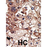 Epidermal Growth Factor Receptor Pathway Substrate 8 (EPS8) Antibody