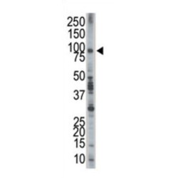Epidermal Growth Factor Receptor Pathway Substrate 8 (EPS8) Antibody