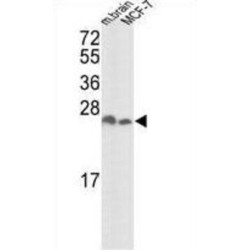 14-3-3 Protein Zeta/Delta (YWHAZ) Antibody