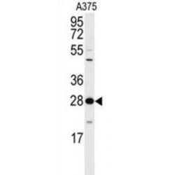 14-3-3 Protein Zeta/Delta (YWHAZ) Antibody