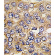 6-Phosphofructo-2-Kinase/fructose-2,6-Biphosphatase 4 (PFKFB4) Antibody