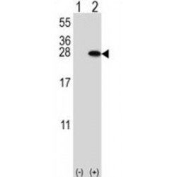 14-3-3 Protein Beta/Alpha (YWHAB) Antibody