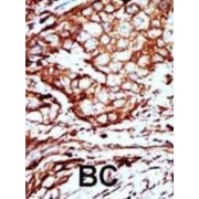 abx033918