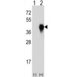 Urokinase Plasminogen Activator Surface Receptor / uPAR / CD87 (PLAUR) Antibody
