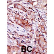 Calcium And Integrin-Binding Family Member 2 (CIB2) Antibody