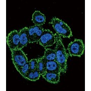 Plasminogen Activator, Urokinase (uPA) Antibody