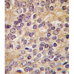 Plasminogen Activator, Urokinase (uPA) Antibody