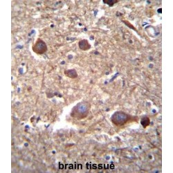 Inositol-Trisphosphate 3-Kinase B (ITPKB) Antibody