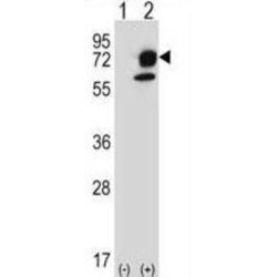 Inositol-Trisphosphate 3-Kinase B (ITPKB) Antibody