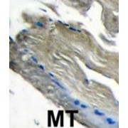 PI3CKG Antibody