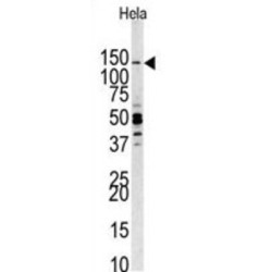 PI3CKG Antibody