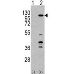 PI3CKG Antibody
