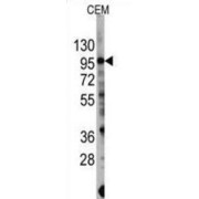 Phosphatidylinositol 4,5-Bisphosphate 3-Kinase Catalytic Subunit Gamma Isoform (PIK3CG) Antibody