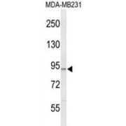 Phosphatidylinositol 4,5-Bisphosphate 3-Kinase Catalytic Subunit Gamma Isoform (PIK3CG) Antibody