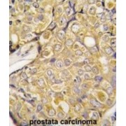 Transient Receptor Potential Cation Channel Subfamily M Member 8 (TRPM8) Antibody