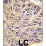 Protein-Tyrosine Phosphatase MEG2 (MEG2) Antibody