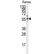 protein Tyrosine Phosphatase 1B (PTP1B) Antibody