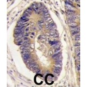 Protein-Tyrosine Phosphatase H1 (PTPH1) Antibody