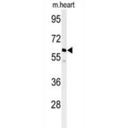 Protein Phosphatase, Mg2+/Mn2+ Dependent 1G (PPM1G) Antibody