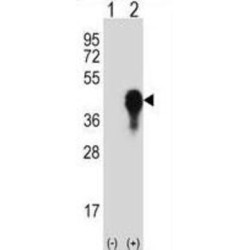 Dual Specificity Protein Phosphatase 6 (DUSP6) Antibody