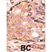 Dual Specificity Phosphatase 4 (DUSP4) Antibody