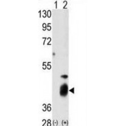 Dual Specificity Protein Phosphatase 7 (DUSP7) Antibody