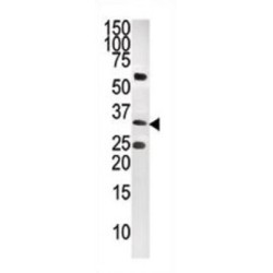 CTDSP1-V250 Antibody