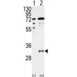 CTDSP1-V250 Antibody