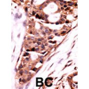 Protein Phosphatase 3 Catalytic Subunit Beta (PPP3CB) Antibody