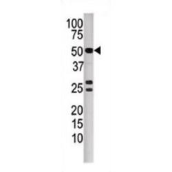Protein Phosphatase 3 Catalytic Subunit Beta (PPP3CB) Antibody