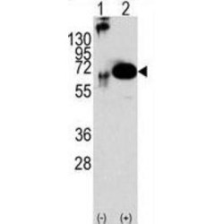 SH-PTP2 (SHP2) Antibody