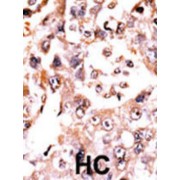 Dual Specificity Phosphatase 3 (DUSP3) Antibody