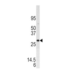 Dual Specificity Phosphatase 3 (DUSP3) Antibody