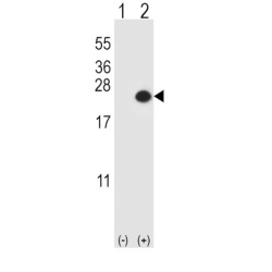 Dual Specificity Phosphatase 3 (DUSP3) Antibody