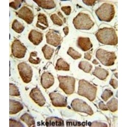 Casein Kinase 2-Interacting Protein 1 (CKIP-1) Antibody