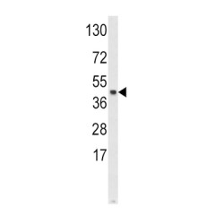S-Phase Kinase-Associated Protein 2 (SKP2) Antibody