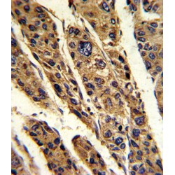 Translationally-Controlled Tumor Protein (TPT1) Antibody