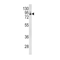 Cytosolic Phospholipase A2 (PLA2G4A) Antibody