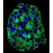 Natural Resistance-Associated Macrophage Protein 1 (SLC11A1) Antibody