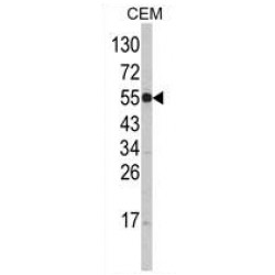 Natural Resistance-Associated Macrophage Protein 1 (SLC11A1) Antibody