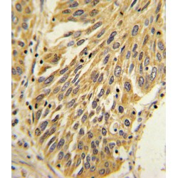 Interleukin 1 Beta (IL1B) Antibody
